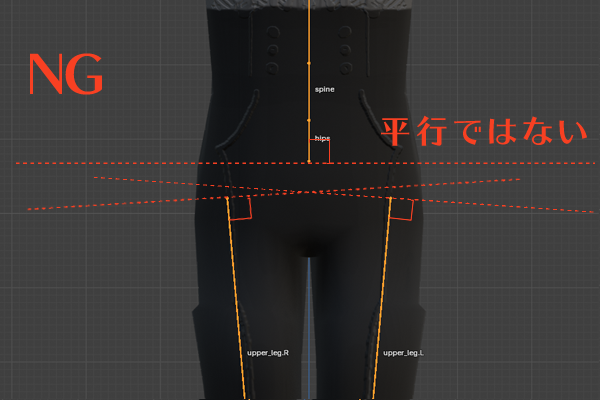 骨盤と大腿骨の角度エラー